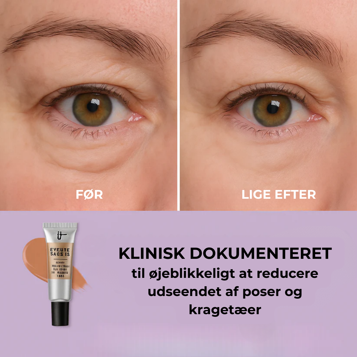 Lisseur Instantané Contour des Yeux Éclat™