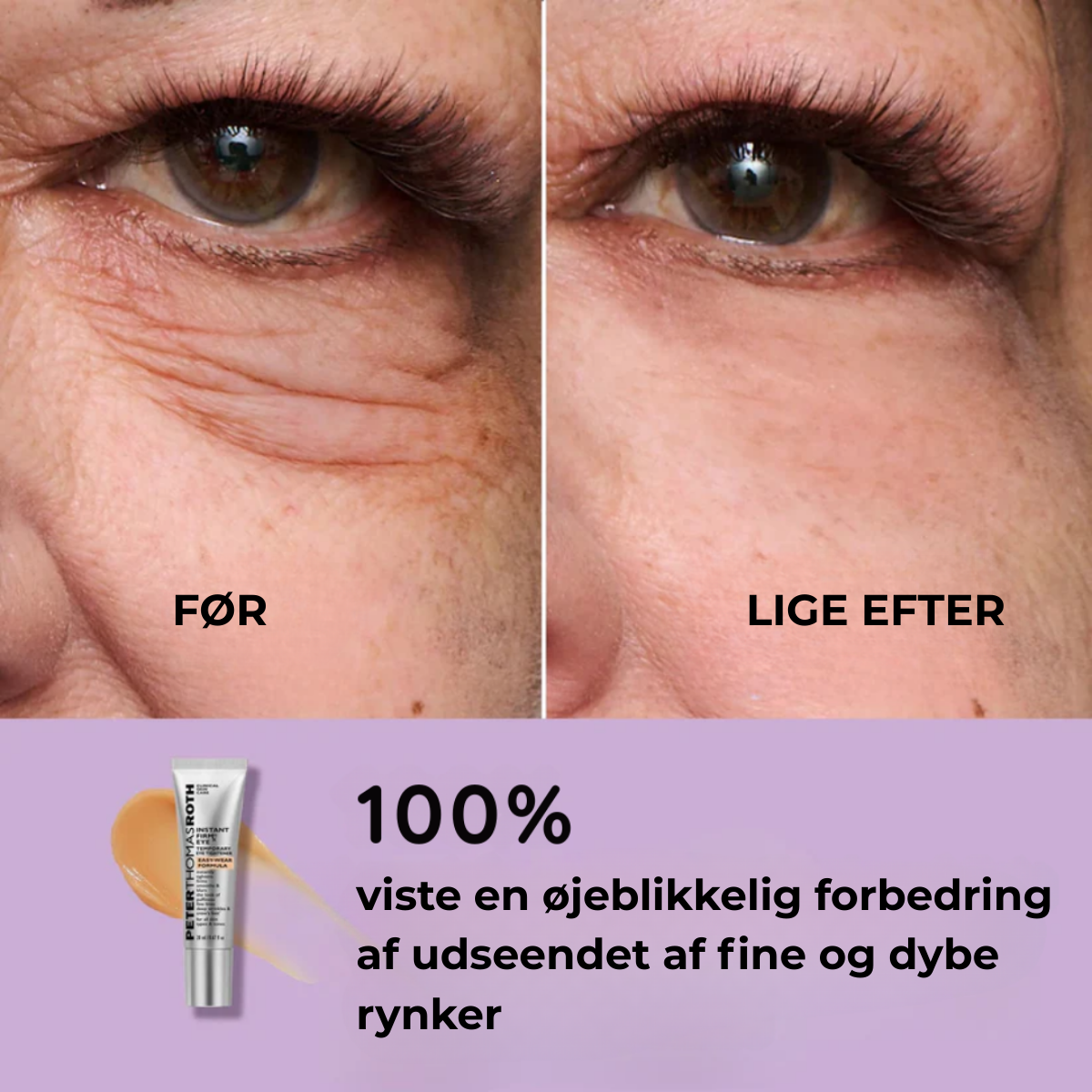 Lisseur Instantané Contour des Yeux Éclat™