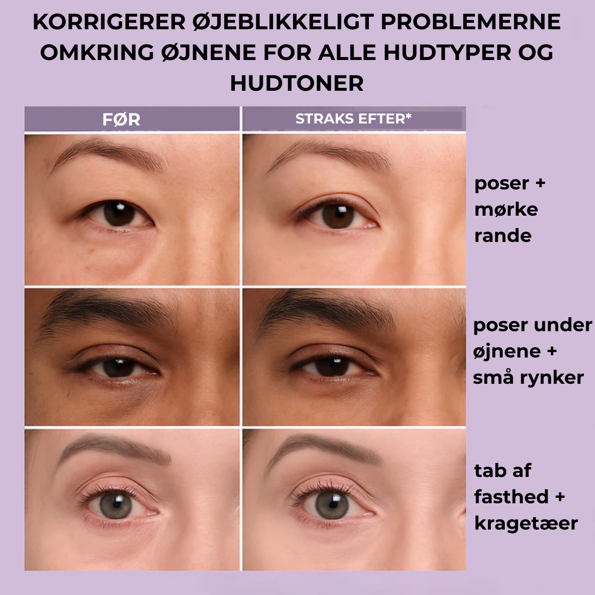 Lisseur Instantané Contour des Yeux Éclat™