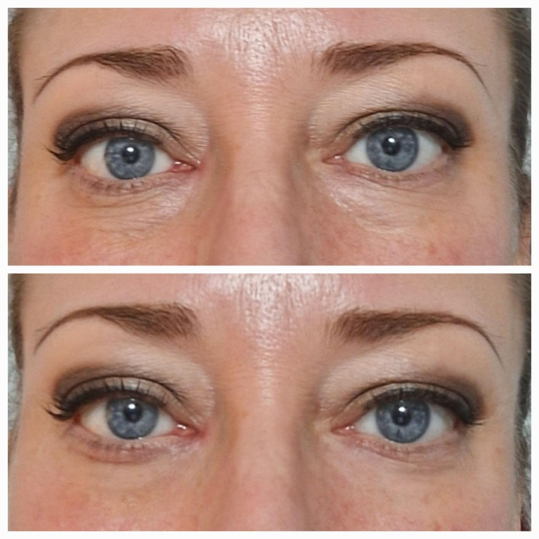 Lisseur Instantané Contour des Yeux Éclat™